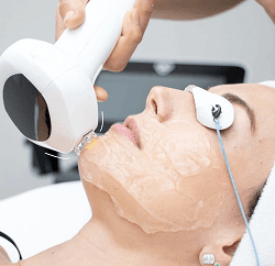 IPL Photo Facial